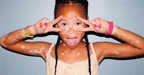 10 Year Old Model April Star Is A Lesson In Self Acceptance Huffpost
