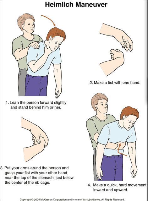 Heimlich Maneuver For Adults Children Infants Pregnant Women