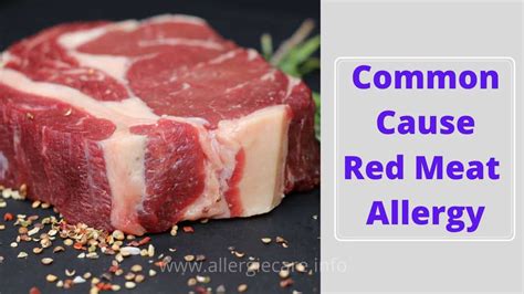 Common Cause Red Meat Allergy Allergie Care