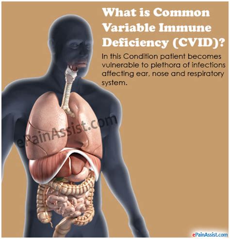 What Is Common Variable Immune Deficiency Cvidcausessymptomssigns