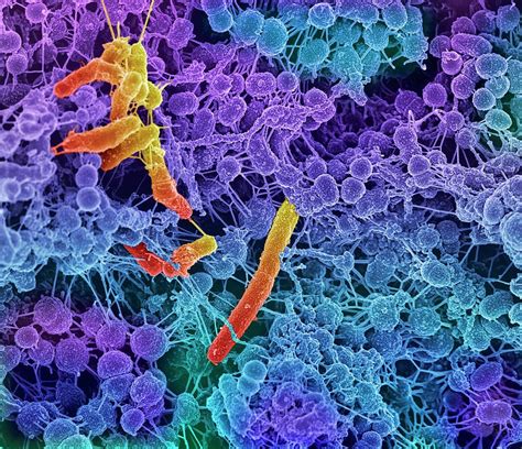 Oral Bacteria Photograph By Science Photo Library Pixels