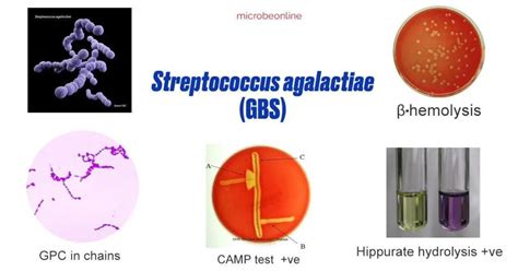 Streptococcus Agalactiae Gbs Properties Pathogenesis Lab Diagnosis • Microbe Online