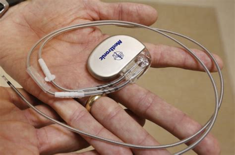 Living With Pacemaker A Tiny Device That Monitors Your Heart Rhythm