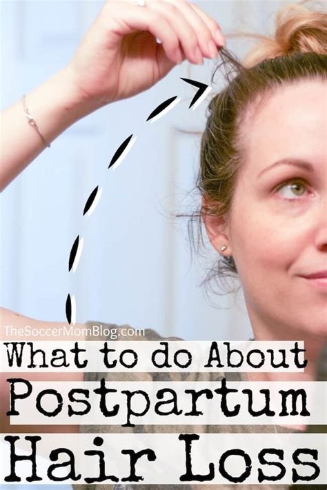 Postpartum Hair Loss How To Deal The Soccer Mom Blog
