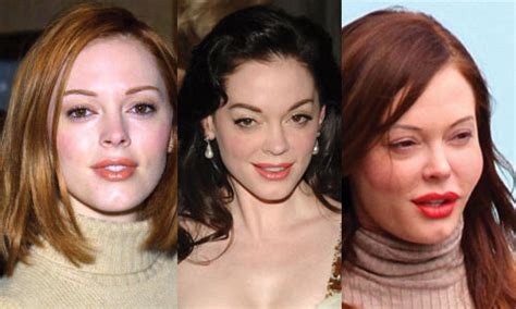 Rose Mcgowan Plastic Surgery Before And After Pictures 2019