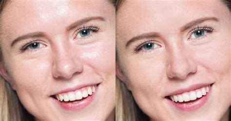Quick Tip How To Fix Shiny Skin In Photoshop And Lightroom Photoshop
