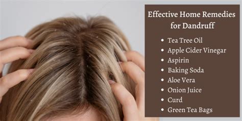 14 Home Remedies For Dandruff Causes And Tips To Prevent Dandruff