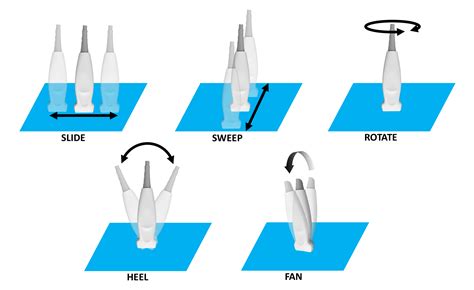 Understanding Ultrasound Probes Kidsono