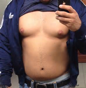 HELP Is This Gyno Or Just Fat PICS