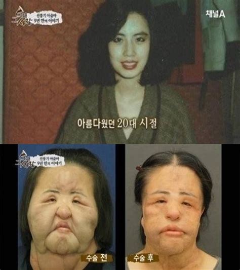 선풍기 아줌마 한혜경 사망 누리꾼 추모 물결 “이제 고통 없이 편안하셨으면”