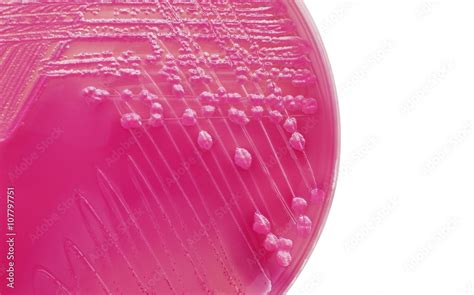 Li Bacterial Colonies On Macconkey Agar Plate Stock Photo Adobe Stock