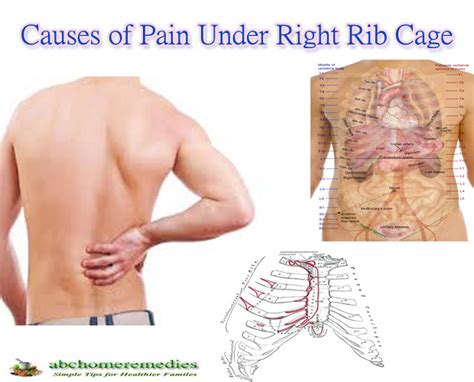 Causes Of Pain Under Right Rib Cage Abchomeremedies