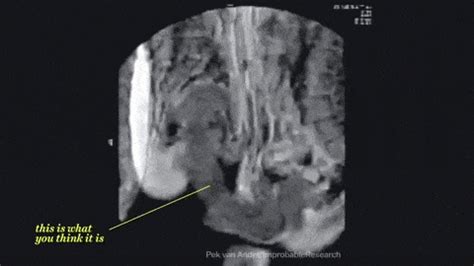 X Ray Gif Find On Gifer