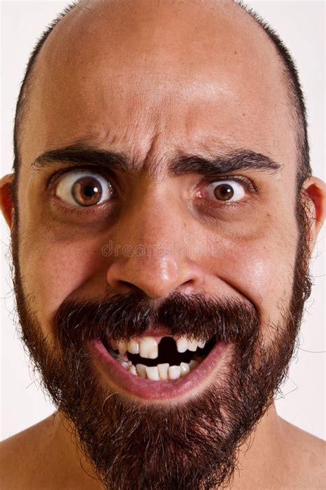 Funny Man Without A Tooth Stock Photo Image Of Funny 15657512