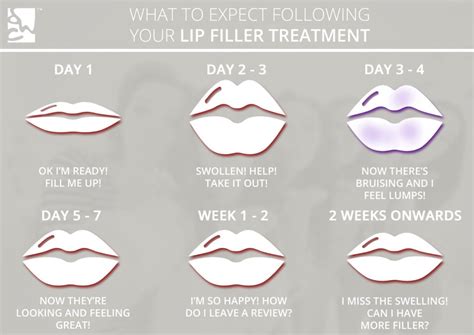 How To Treat Swelling After Lip Fillers