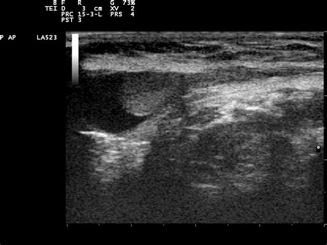 We did not find results for: File:Ultrasound Scan ND 0118093937 0944220.png - Wikimedia ...