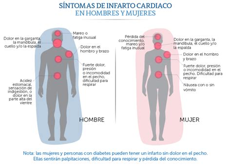 Como reconocer las señales de infarto femenino Prevencionar Perú