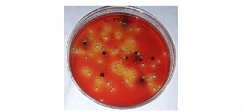 1 Salmonella Spp On Xld Agar Download Scientific Diagram