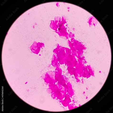 High Vaginal Swab Hvs Gram Stained Microscopic View Of Epithelial