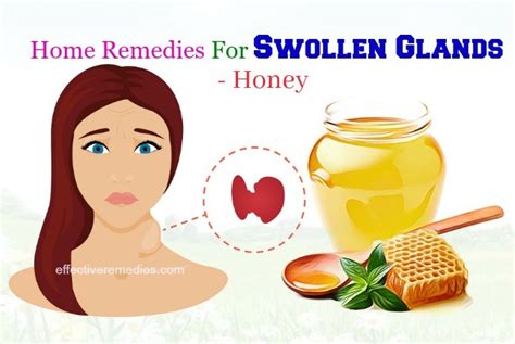 25 Effective Home Remedies For Swollen Glands In Neck And Throat