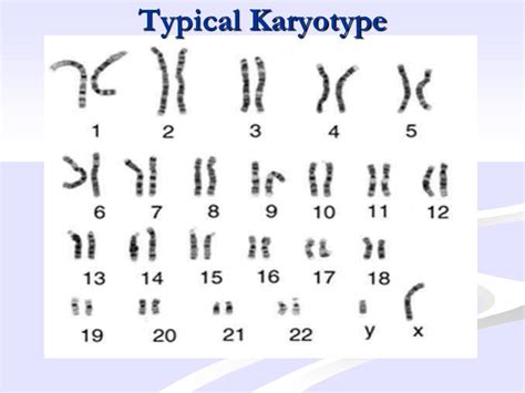 ppt mutations and karyotyping powerpoint presentation free download id 6130053