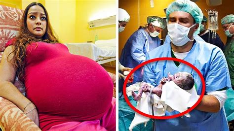 Mom Thinks Shes Having Twins But Drs Quickly Learn Shes Making History With Rare Delivery