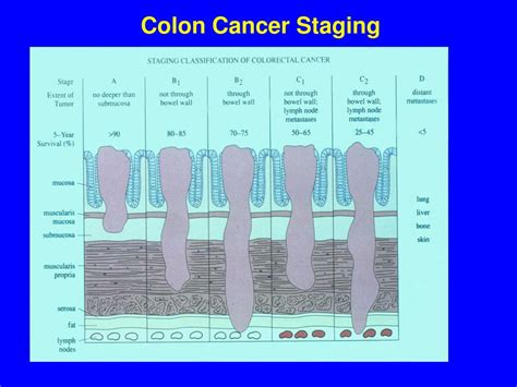 Ppt Colon Cancer Powerpoint Presentation Free Download Id6917417
