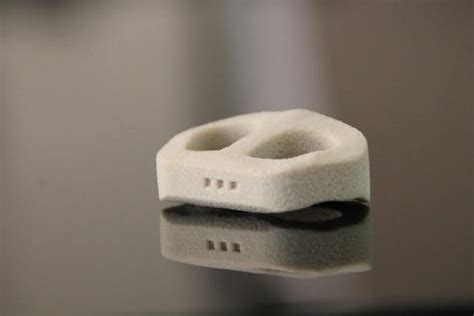 3d Printed Spine Cage Enables Customized Spinal Fusion Surgery