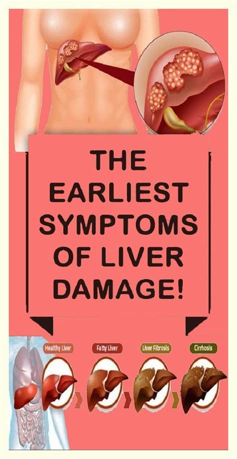 10 Warning Signals Of Liver Damage You Should Not Ignore In 2022