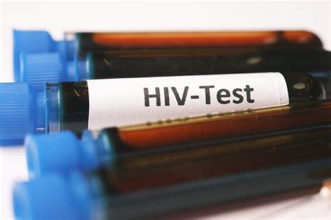 What Is A Non Reactive Hiv Test Result Homey Gears