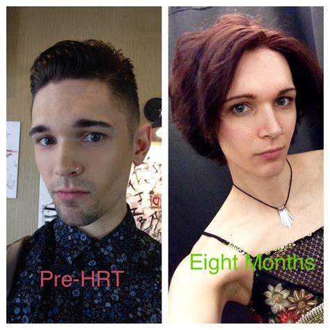 8 Months Before And After Mtf Hrt Rtranstimelines
