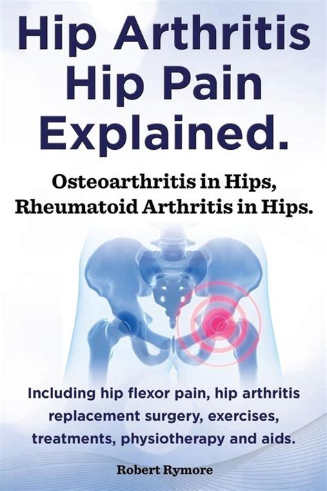 Hip Arthritis Hip Pain Explained Osteoarthritis In Hips Rheumatoid