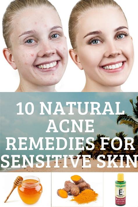 10 Natural Acne Remedies For Sensitive Skin Baking Soda In 2020
