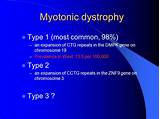 Pictures of Hyperthyroid Myopathy Treatment