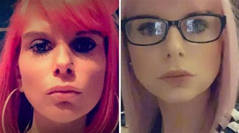 Mujer utilizó mucho botox en los labios y terminó desfigurada FOTO