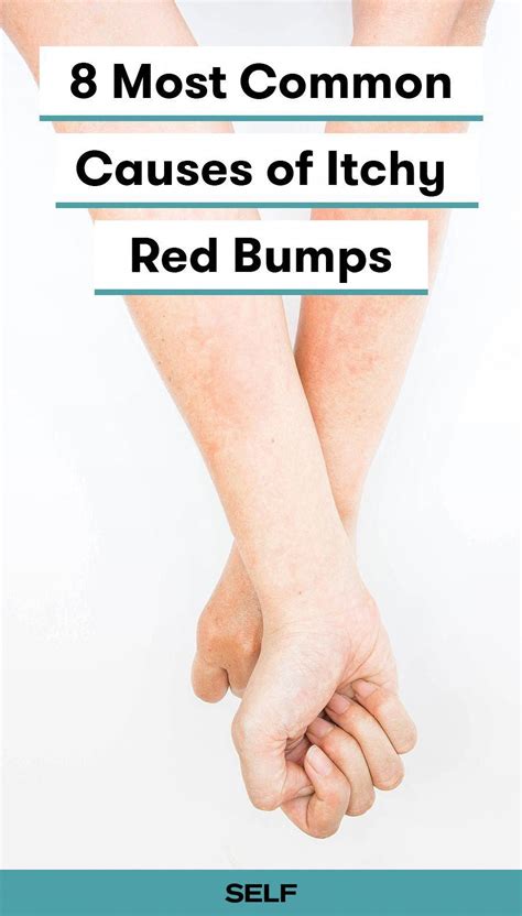 Common Causes Of Itchy Red Bumps And Skin Rashes Severe Itchy