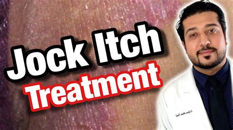 How To Treat Jock Itch Fast Jock Itch Treatment Causes And Prevention 2021 Youtube