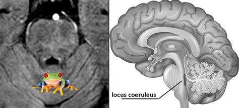 In Vivo Visualization Of Locus Coeruleus Using Mtc Stage Imaging
