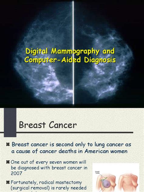 Breast Cancer Breast Cancer Mammography