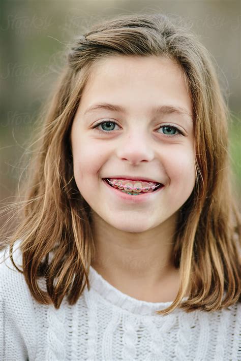 Close Up Portrait Of A Young Girl With Long Hair And Braces By