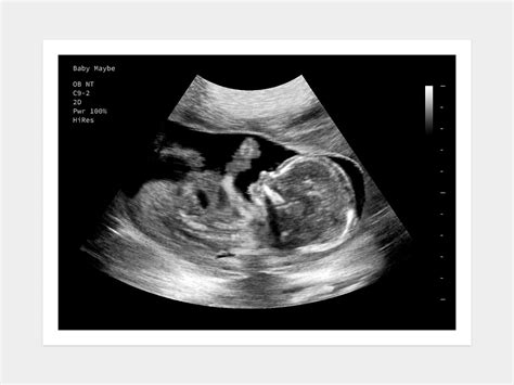 16 Weeks Fake Ultrasound W Instant Download