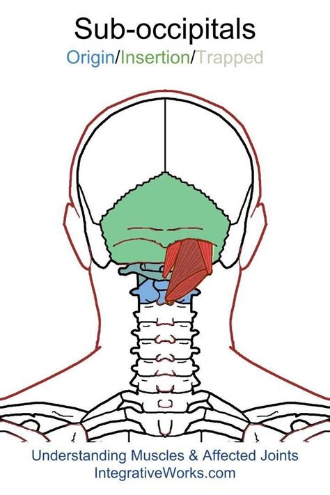 Sub Occipital Muscles Headache Or Migraine In A Band Or All Over
