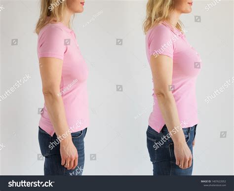 Side View Woman Before After Breast Stock Photo Edit Now 1407622052