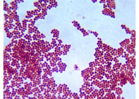 Gram Staining Of Staph Aureus Showing Typical Gram Positive Cocci