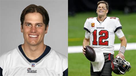 Tom Brady Before And After Did He Get Plastic Surgery