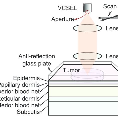 The three other specifications have determined the na! LFI with an RCM implementation based on a VCSEL as both ...