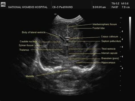 Pin By Gina Cerniglia On Anatomy Ultrasound Sonography Diagnostic