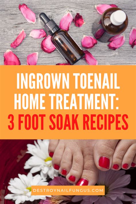 3 Best Foot Soaks For Ingrown Toenail The Complete Guide