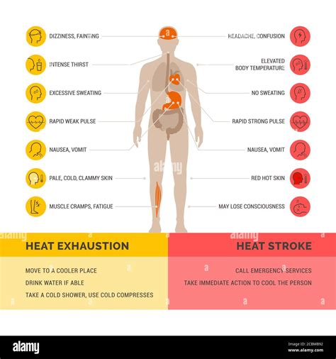 How Long Heat Stroke Symptoms Best Design Idea