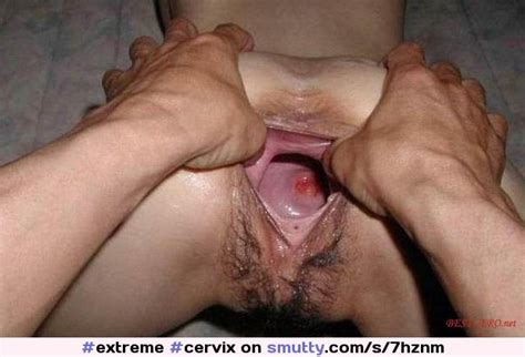 Extreme Cervix Heldopen Stretched Pussy Stretchedcunt Internal Insidevagina Openpussy